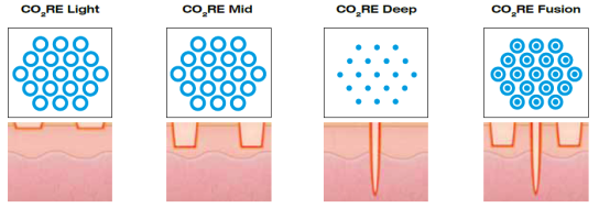 CO2RE(コア2)複数のモード