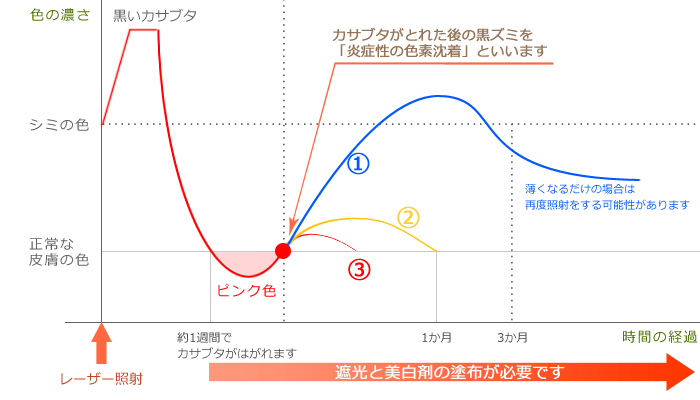 Qスイッチレーザー レーザー照射後の経過
